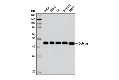 beta actin antibody|beta Actin Antibody (D6A8) .